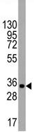Anti-UTF1 antibody (ab65453) at 1/60 dilution + NCI-H460 cell line lysate at 35 µg