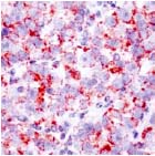 Human seminoma stained with ab17851.