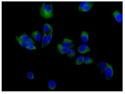 Immunofluorescent analysis of SH-SYSY cells (4% paraformaldehyde-fixed) labeling VAMP2 with ab181869 at 1/500 dilution followed by Goat anti rabbit IgG (Alexa Fluor®488) at 1/200 dilution and counterstained with Dapi.