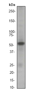 Anti-Smad3 antibody [EP568Y] (ab40854) at 1/5000 dilution (unpurified) + Jurkat cell lysate at 10 µg