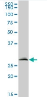 Anti-VAPB antibody (ab67062) at 1/500 dilution + Human liver lysate at 25 µgSecondaryGoat anti-mouse IgG (H&L)-HRP conjugate at 1/2500 dilution
