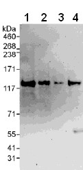 All lanes : Anti-VARP antibody (ab108216) at 0.1 µg/mlLane 1 : HeLa whole cell lysate at 50 µgLane 2 : HeLa whole cell lysate at 15 µgLane 3 : HeLa whole cell lysate at 5 µgLane 4 : 293T whole cell lysate at 50 µgdeveloped using the ECL technique