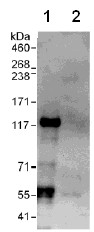 Detection of VARP by Western Blot of Immunprecipitate. Lane 1: ab108216 at 1µg/ml staining VARP in HeLa whole cell lysate immunoprecipitated using ab108216 at 6µg/mg lysate (1 mg/IP; 20% of IP loaded/lane). Lane 2: Control IgG Detection: Chemiluminescence with exposure time of 30 seconds.