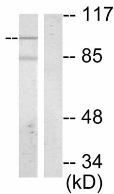 All lanes : Anti-Vav proteins (phospho Y174) antibody (ab47282) at 1/500 dilutionLane 1 : Extrats from Jurkat cells treated with UV Lane 2 : Extrats from Jurkat cells untreatedLysates/proteins at 30 µg per lane.