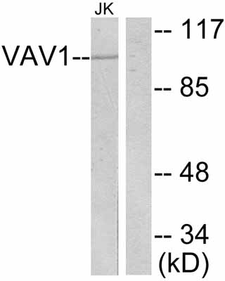 All lanes : Anti-VAV1 antibody (ab47403) at 1/500 dilutionLane 1 : Jurkat cell extractLane 2 : Jurkat cell extract with blocking peptide