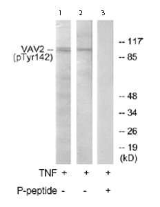 All lanes : Anti-VAV2 (phospho Y142) antibody (ab73707) at 1/500 dilutionLane 1 : Extracts from K562 cells treated with TNF (200ng/ml, 30mins)Lane 2 : Extracts from Hela cells treated with TNF (200ng/ml, 30mins)Lane 3 : Extracts from K562 cells treated with TNF (200ng/ml, 30mins) plus 5µg immunizing phosphopeptideLysates/proteins at 5 µg per lane.