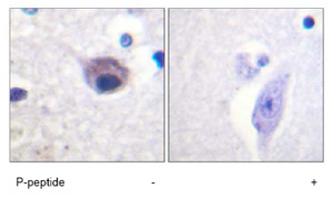 Immunohistochemistry analysis of paraffin-embedded human brain tissue using ab73707 at a 1:50 dilution.Left image un-treated.Right image treated with immunizing phosphopeptide.