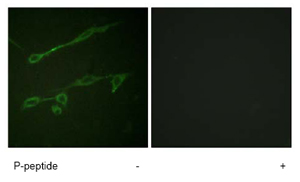 Immunofluorescence analysis of NIH/3T3 cells using ab73707 at a 1:500 dilution.Left image un-treated.Right image treated with immunizing phosphopeptide.
