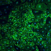 A confocal microscopy image of Endothelial cells from the breast expressing VE-cadherin. This image was kindly submitted as part of the review by Valgardur Sigurdsson.