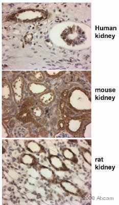 ab46154 staining kidney tissue sections (human, mouse and rat) by IHC-P. Sections were formaldehyde fixed and subjected to heat mediated antigen retrieval prior to blocking with sequential peroxidase and protein block (prediluted) for 20 minutes at 20°C. The anti-VEGF antibody was diluted 1/100 and incubated with the samples for 45 minutes at 20°C. A HRP-conjugated goat anti-rabbit antibody was used as the secondary.See Abreview