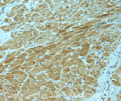 IHC image of VEGF staining in human heart formalin fixed paraffin embedded tissue section, performed on a Leica BondTM system using the standard protocol F. The section was pre-treated using heat mediated antigen retrieval with sodium citrate buffer (pH6, epitope retrieval solution 1) for 20 mins. The section was then incubated with ab46154, 5µg/ml, for 15 mins at room temperature and detected using an HRP conjugated compact polymer system. DAB was used as the chromogen. The section was then counterstained with haematoxylin and mounted with DPX.