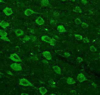 ab39250 staining VEGF in mouse brain tissue by Immunohistochemistry (Free floating sections). A heat mediated antigen retrieval step (100°C for 20 minutes) was performed using 10mM sodium citrate buffer, 0.05% Tween 20 pH 6.0. Samples were then incubated with the primary antibody at a 1/100 dilution for 72 hours at 4°C. An Alexa Fluor®488-conjugated goat anti-rabbit polyclonal was used as secondary antibody at a 1/500 dilution.ab39250 staining VEGF in mouse brain tissue by Immunohistochemistry (Free floating sections). A heat mediated antigen retrieval step (100°C for 20 minutes) was performed using 10mM sodium citrate buffer, 0.05% Tween 20 pH 6.0. Samples were then incubated with the primary antibody at a 1/100 dilution for 72 hours at 4°C. An Alexa Fluor®488-conjugated goat anti-rabbit polyclonal was used as secondary antibody at a 1/500 dilution.See Abreview