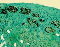ab3109 staining VEGF in mouse islet grafts by Immunohistochemistry (FFPE-sections).