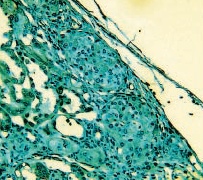 ab3109 staining VEGF in mouse islet grafts by Immunohistochemistry (FFPE-sections). 
