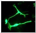 Immunofluorescent staining of HUVEC cells using ab52917 (1:250).