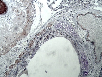ab2350 staining the VEGF Receptor 1 in Mouse lung tissue sections by Immunohistochemistry (IHC-P - formaldehyde-fixed, paraffin-embedded sections). Tissue was fixed with formaldehyde and blocked with 10% serum for 1 hour at room temperature; antigen retrieval was by heat mediation in citrate buffer (pH 6). Samples were incubated with primary antibody (1/100) for 16 hours at 4°C. An undiluted biotin-conjugated Goat anti-rabbit IgG polyclonal was used as the secondary antibody.See Abreview