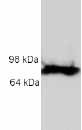 Anti-Versican antibody (ab19345) at 1 µg/ml + Lysates prepared from human aorta.