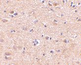 ab69989 at 5 µg/ml staining VGF in human brain tissue section by Immunohistochemistry (Formalin/ PFA fixed paraffin-embedded sections).
