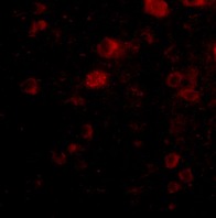 Immunofluorescence of VGF in Human Brain cells using ab69989 at 20 ug/ml.