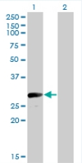 All lanes : Anti-VGLL1 antibody (ab77019) at 5 µg/mlLane 1 : VGLL1 transfected 293T cell lysateLane 2 : Non-transfected 293T cell lysateLysates/proteins at 25 µg per lane.SecondaryGoat Anti-Mouse IgG (H&L)-HRP Conjugate at 1/2500 dilution