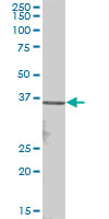 Anti-VGLL2 antibody (ab72666) at 1/500 dilution + human kidney tissue lysate at 25 µgSecondaryGoat Anti-Mouse IgG (H&L)-HRP Conjugate at 1/2500 dilution