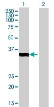 All lanes : Anti-VGLL2 antibody (ab72666) at 1/500 dilutionLane 1 : VGLL2 transfected 293T cell lysate Lane 2 : Non transfected 293T cell lysate Lysates/proteins at 25 µg per lane.SecondaryGoat Anti-Mouse IgG (H&L)-HRP Conjugate at 1/2500 dilution