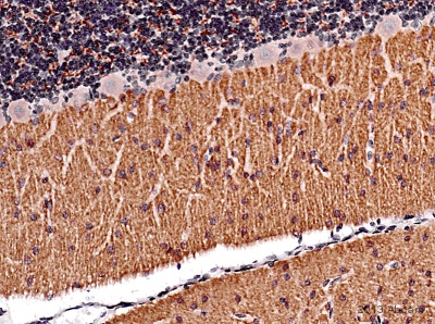 IHC-P image of VGlut1 staining on rat cerebellum section using ab104898 (1:4000). The sections were deparaffinized and subjected to heat mediated antigen retrieval using citric acid. The sections were blocked using 1% BSA for 10 mins at 21°C. ab104898 was diluted 1:4000 and incubated with the sections for 2 hours at 21°C. The secondary antibody used was goat polyclonal to rabbit IgG conjugated to biotin (undiluted).