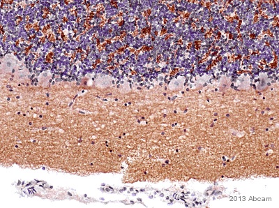 IHC-P image of VGlut1 staining on Cat cerebellum section using ab104898 (1:4000). The sections were deparaffinized and subjected to heat mediated antigen retrieval using citric acid. The sections were blocked using 1% BSA for 10 mins at 21°C. ab104898 was diluted 1:4000 and incubated with the sections for 2 hours at 21°C. The secondary antibody used was goat polyclonal to rabbit IgG conjugated to biotin (1:250).