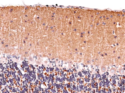 IHC-P image of VGlut1 staining on marmoset cerebellum section using ab104898 (1:4000). The sections were deparaffinized and subjected to heat mediated antigen retrieval using citric acid. The sections were blocked using 1% BSA for 10 mins at 21°C. ab104898 was diluted 1:4000 and incubated with the sections for 2 hours at 21°C. The secondary antibody used was goat polyclonal to rabbit IgG conjugated to biotin (1:250).