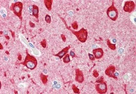 Immunohistochemical analysis of formalin-fixed, paraffin-embedded Human brain cortex tissue labeling VILIP1 with ab190155 at 1/10 dilution.