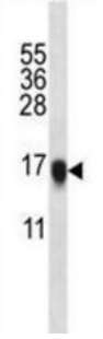 Anti-VILIP1 antibody (ab190155) at 1/1000 dilution + Mouse heart tissue lysates at 35 µg
