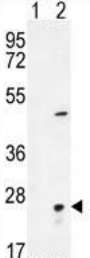 All lanes : Anti-VILIP1 antibody (ab190155) at 1/1000 dilutionLane 1 : Non-transfected 293 cell lysatesLane 2 : VILIP1-transfected 293 cell lysatesLysates/proteins at 2 µg per lane.