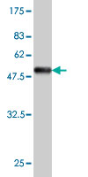 Western blot against tagged recombinant protein immunogen using ab58053 VILIP1 antibody at 1ug/ml.