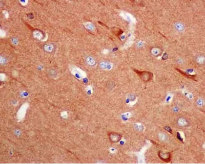 Immunohistochemical analysis of paraffin-embedded Human brain tissue labeling VILIP1 with ab180141 at 1/500 dilution. Secondary antibody Goat anti rabbit IgG(HRP) prediluted. Counter stain Hematoxylin.
