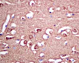 Immunohistochemical analysis of paraffin-embedded Human brain tissue labeling VILIP1 with ab151741 at 1/100 diluton.