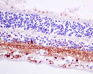 Immunohistochemical analysis of paraffin embedded Human Retina tissue using ab151741 showing +ve staining.