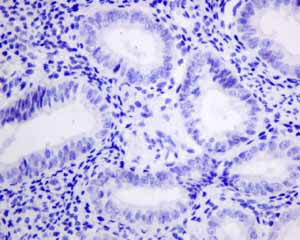 Immunohistochemical analysis of paraffin embedded normal Human uterus tissue using ab151741 showing -ve staining.