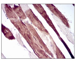 Immunohistochemical analysis of paraffin embedded Human muscle tissue labeling Villin using ab202021 at 1/200 dilution, followed by DAB staining.