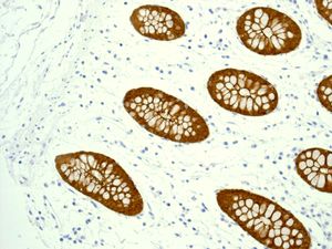 Immunohistochemical analysis of paraffin-embedded Human colon tissue labelling Villin with ab133510 at 1/100 dilution.
