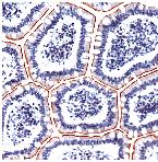 ab52135, used neat, staining Human Villin in Small intestine using Immunohistochemistry, Formalin fixed Paraffin embedded tissue.