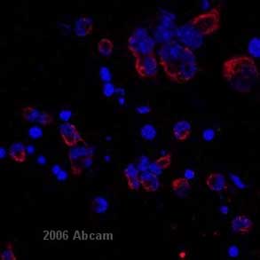 ab20346 at a 1/500 dilution staining mouse dissociated neural precursor cells by immunocytochemistry. The antibody was incubated with the cells for 1 hour and then detected using a goat anti-mouse Alexa-Fluor 568 (red stain) ab175473>ab175473). The image also shows a blue nuclear counterstain. Confocal image is shown with 2x zoom detail in top right corner.This image is courtesy of an Abreview submitted by Randal Moldich on 22 February 2006.See Abreview