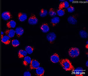  ab28028 at 1/200 dilution staining vimentin in human lung cancer cells. The Vimentin staining is shown in red. The cells were counterstained with DAPI. Please see accompanying abreview for additional information.See Abreview