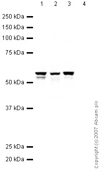 All lanes : Anti-Vimentin antibody - Cytoskeleton Marker (ab45939) at 1 µg/mlLane 1 : HeLa (Human epithelial carcinoma cell line) Whole Cell Lysate Lane 2 : Jurkat (Human T cell lymphoblast-like cell line) Whole Cell Lysate Lane 3 : HEK293 Human embryonic kidney cell line Whole Cell Lysate Lane 4 : Ramos (Human Burkitt's lymphoma cell line) Whole Cell Lysate Lysates/proteins at 10 µg per lane.SecondaryIRDye 680 Conjugated Goat Anti-Rabbit IgG (H+L) at 1/10000 dilutionPerformed under reducing conditions.