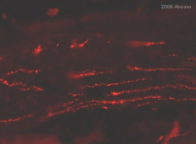 ab22736 staining VIP in jejunum tissue section of pig by Immunohistochemistry (frozen sections). Tissue underwent fixation in paraformaldehyde and incubated with primary antibody, diluted 1/200 for 24 hours. A Texas Red® conjugated goat polyclonal to rabbit, dilution 1/400 was used as the secondary.See Abreview