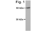 Anti-Visfatin antibody (ab24149) + Human adipose tissue lysateObserved band size : 52 kDa (why is the actual band size different from the predicted?)