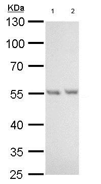 All lanes : Anti-Visfatin antibody (ab184007) at 1/1000 dilutionLane 1 : 293T whole cell lysateLane 2 : A431 whole cell lysateLysates/proteins at 30 µg per lane.