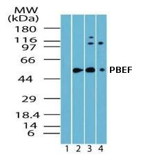 All lanes : Anti-Visfatin antibody (ab72128) at 1/5000 dilutionLane 1 : Pre immune seraLane 2 : Human skeletal muscle lysateLane 3 : Mouse skeletal muscle lysateLane 4 : Rat skeletal muscle lysate