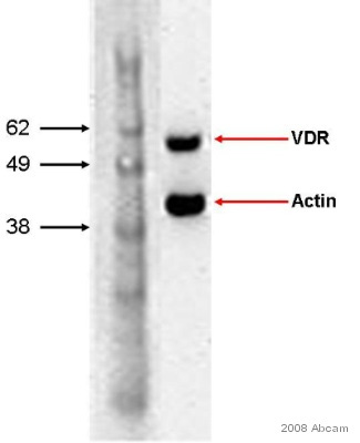 Anti-Vitamin D Receptor antibody [9A7] (ab8756) at 1/1000 dilution + Whole cell lysate prepared from chinese hamster CHO cells at 50000 cellsSecondaryHRP conjugated goat polyclonal to rat Ig at 1/1000 dilutionPerformed under reducing conditions.