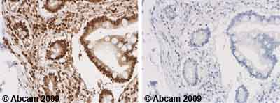 Ab3508 staining Human normal jejunum. Staining is localized to the nucleus.Left panel: with primary antibody at 1/2000. Right panel: isotype control.Sections were stained using an automated system DAKO Autostainer Plus , at room temperature. Sections were rehydrated and antigen retrieved with the Dako 3-in-1 AR buffer, citrate pH 6.0 in a DAKO PT Link. Slides were peroxidase blocked in 3% H2O2 in methanol for 10 minutes. They were then blocked with Dako Protein block for 10 minutes (containing casein 0.25% in PBS) then incubated with primary antibody for 20 minutes and detected with Dako Envision Flex amplification kit for 30 minutes. Colorimetric detection was completed with Diaminobenzidine for 5 minutes. Slides were counterstained with Haematoxylin and coverslipped under DePeX. Please note that for manual staining we recommend to optimize the primary antibody concentration and incubation time (overnight incubation), and amplification may be required.