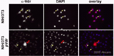 ab3508 staining the Vitamin D Receptor in mVDR-transfected and untransfected Mouse NIH/3T3 cells by ICC/IF (immunocytochemistry/immunofluorescence). Cells were paraformaldehyde fixed, permeabilized with Triton X-100 and blocked with 1% BSA/5%HS for 30 minutes at 20°C. The sample was incubated with the primary antibody (1/50 in 1% BSA/5% HS in 1xPBS) for 1 hour 30 minutes at 20°C. A Cy3®-conjugated goat anti-rabbit polyclonal (1/200) was used as the secondary.See Abreview